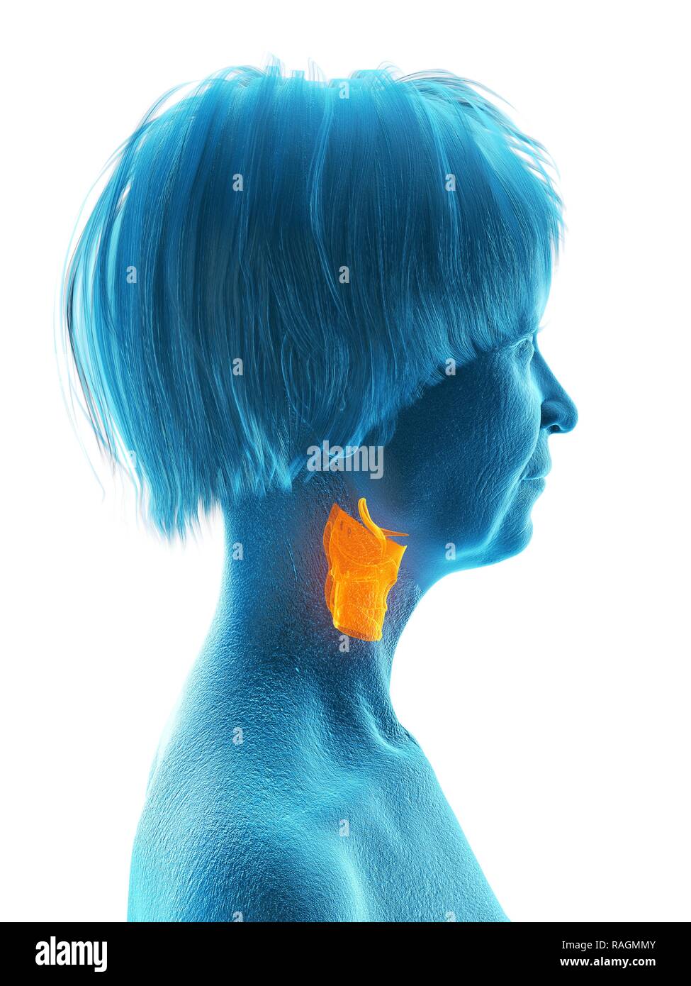 Illustration d'une vieille femme de larynx. Banque D'Images