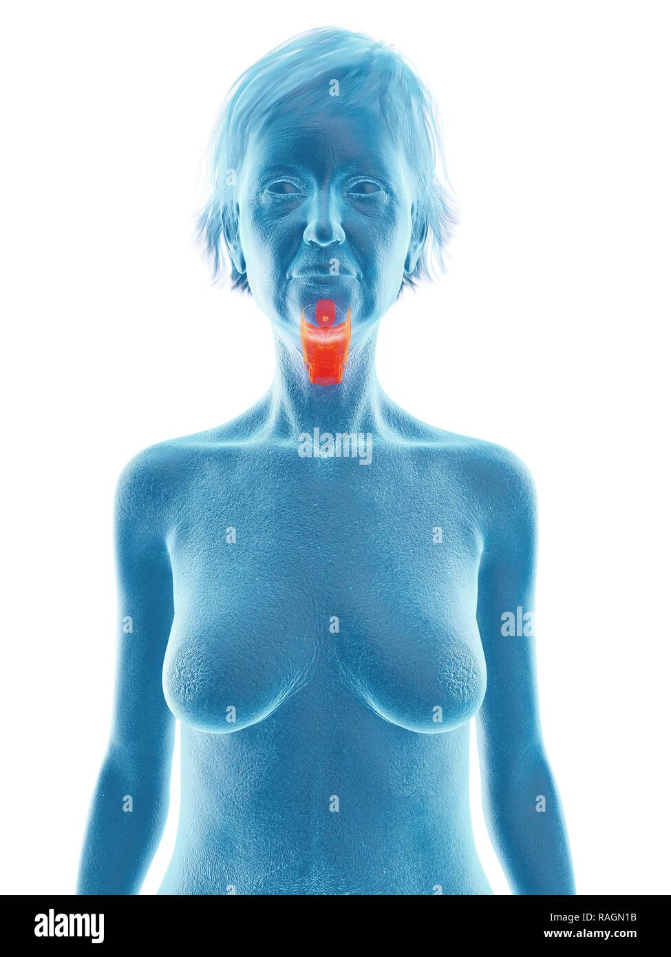 Illustration d'une vieille femme de larynx. Banque D'Images