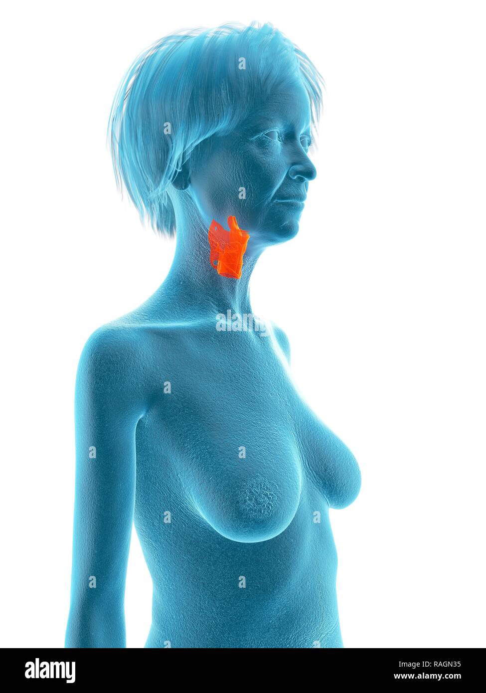 Illustration d'une vieille femme de larynx. Banque D'Images