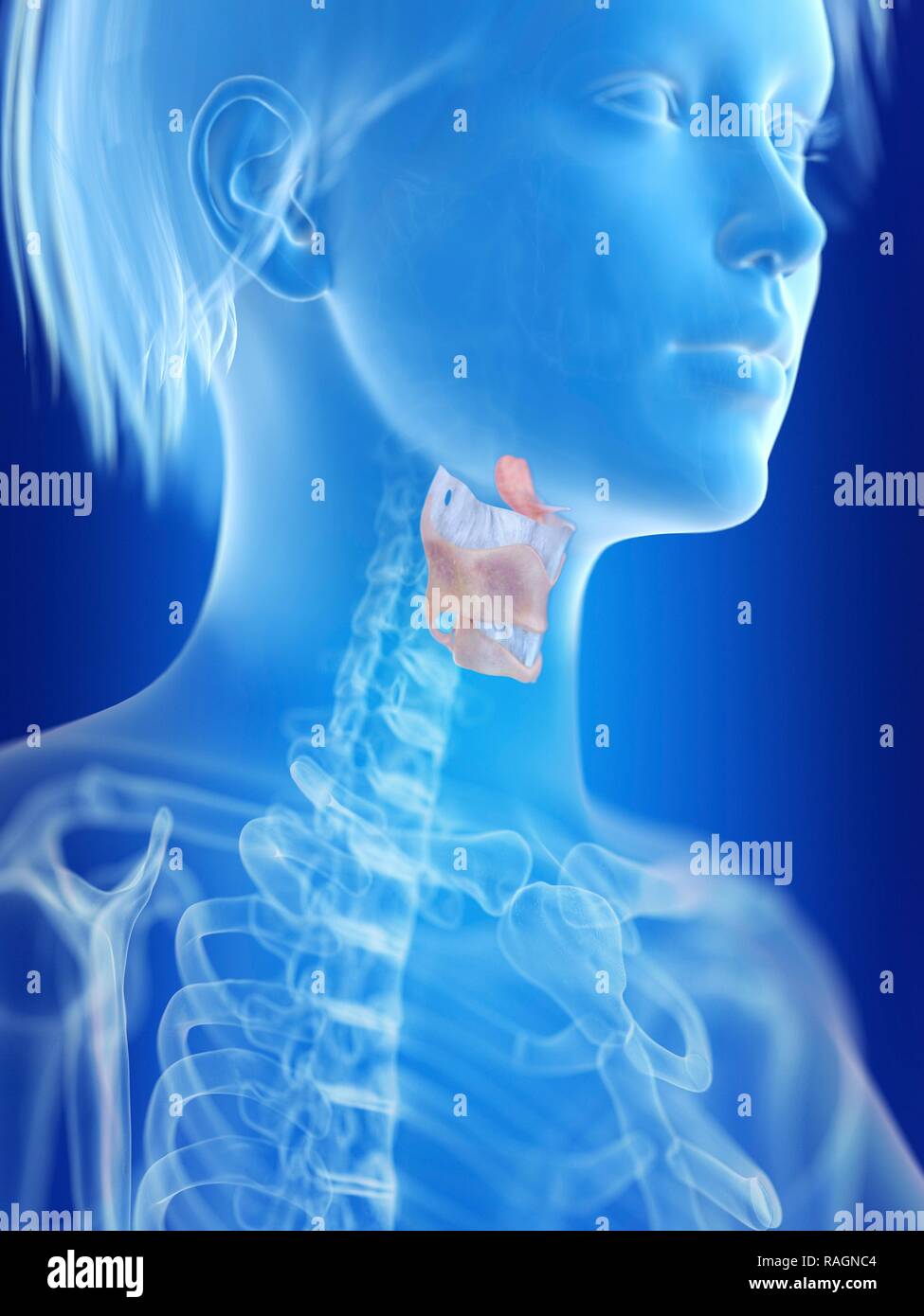 Illustration d'une femme de larynx. Banque D'Images