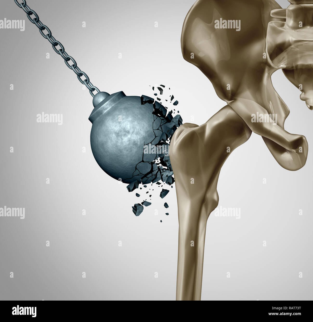 Des os solides et en bonne santé des os de l'orthopédie et de la force dans la densité minérale concept médical comme un boulet détruit par l'ostéoporose. Banque D'Images