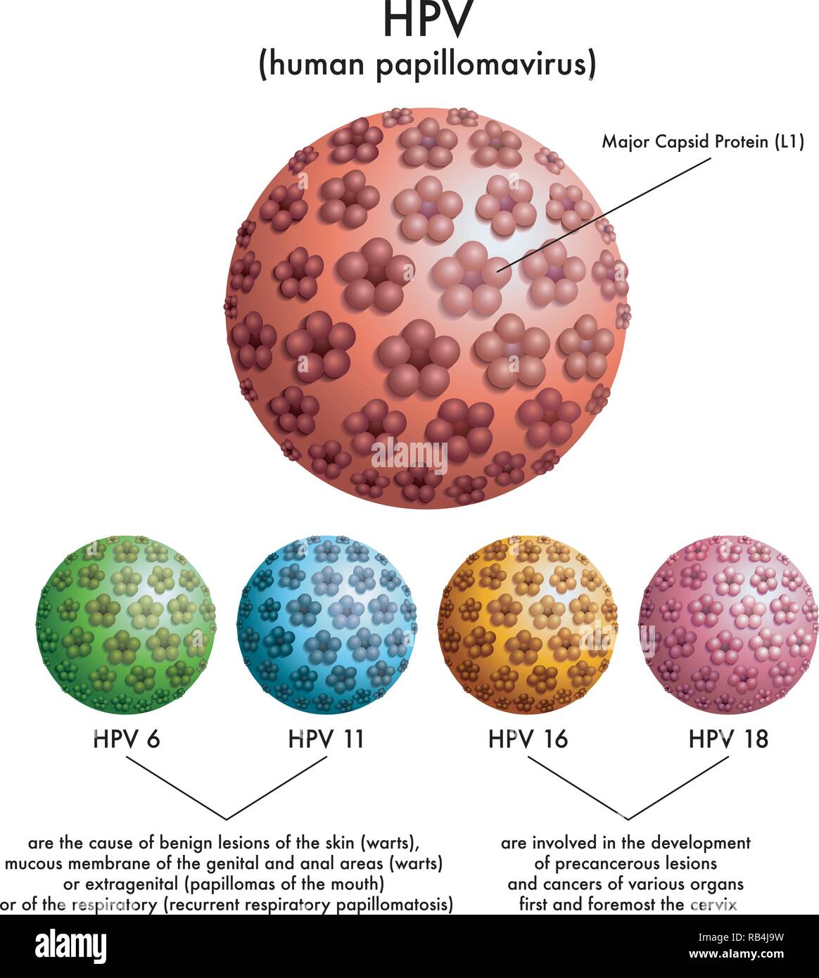 Illustration médicale des différents types de VPH (virus du papillome humain) Illustration de Vecteur