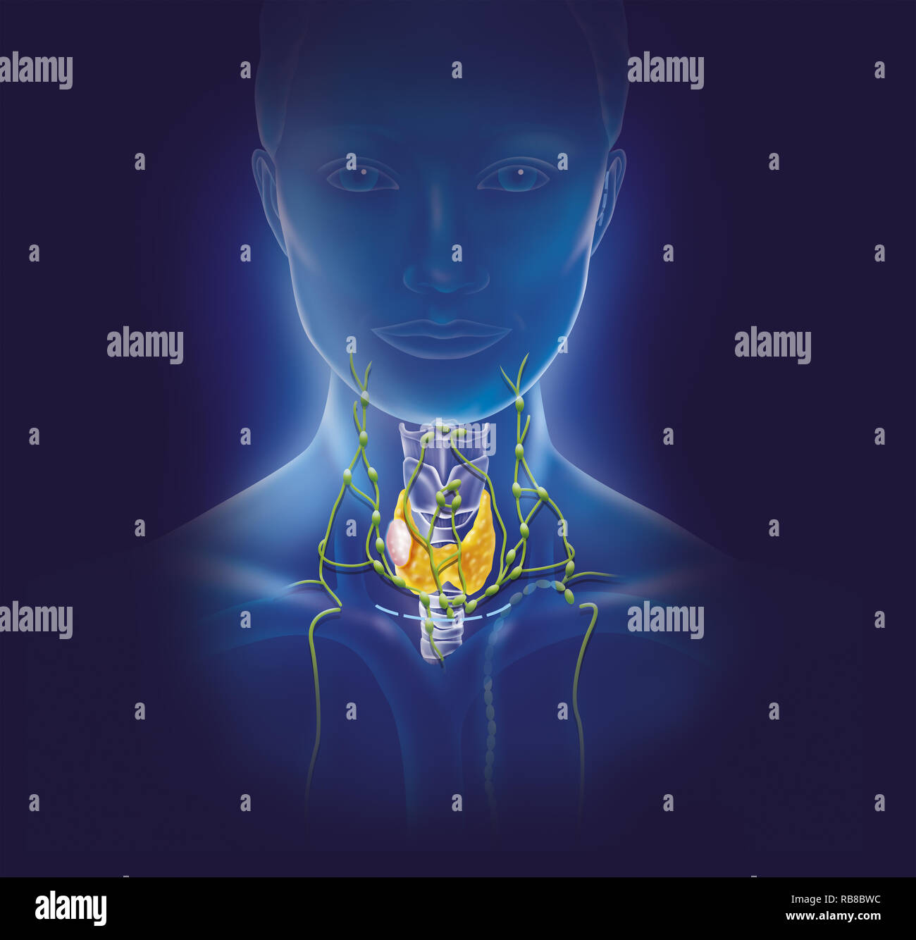 NODULE THYROÏDIEN ILLUSTRATION Banque D'Images