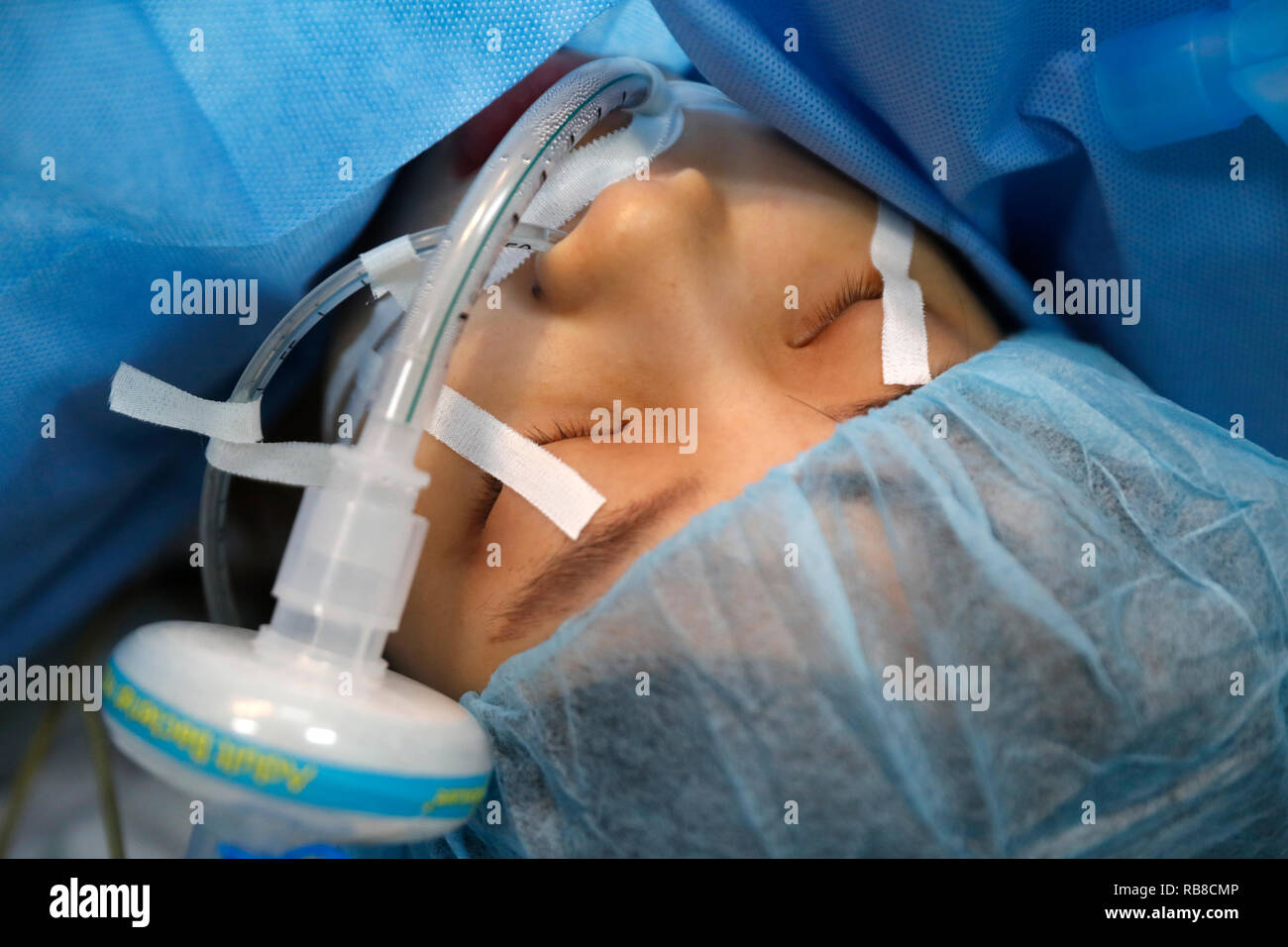 Tam Duc cardiologie Hôpital. Salle d'opération. La chirurgie cardiaque. L'anesthésie. Ho Chi Minh Ville. Le Vietnam. Banque D'Images