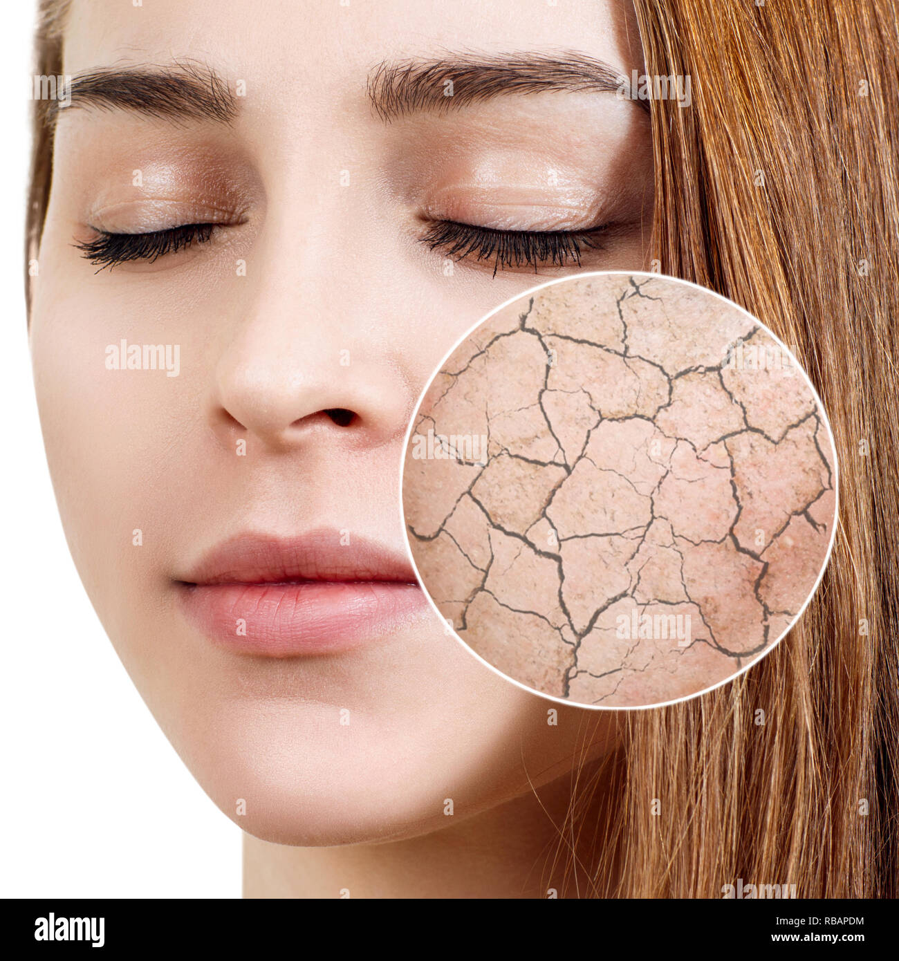 Cercle zoom montre la peau du visage sèche avant de mouiller. Concept de soins de la peau. Banque D'Images