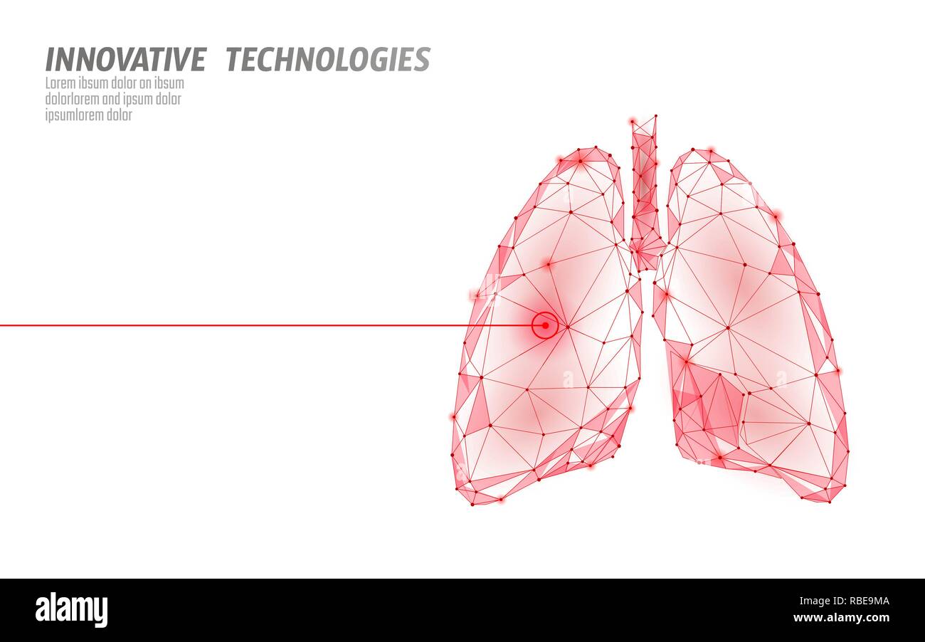 Les poumons de la chirurgie au laser de faible fonctionnement poly. Traitement médicamenteux de la maladie de la médecine région douloureuse. Triangles rouges de rendu 3D polygonale forme. La tuberculose pharmacie modèle cancer vector illustration Illustration de Vecteur