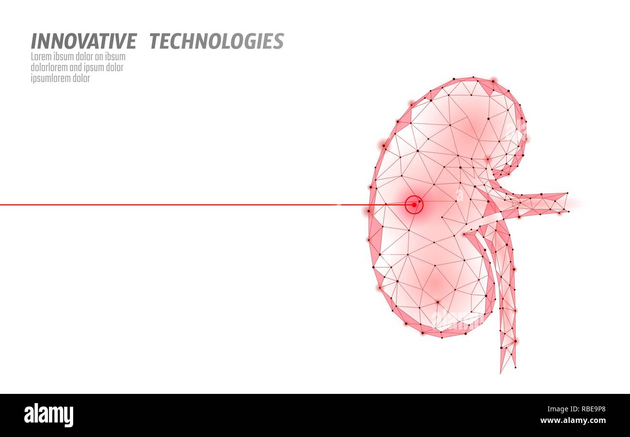La chirurgie au laser des reins faible fonctionnement poly. Traitement médicamenteux de la maladie de la médecine région douloureuse. Triangles rouges de rendu 3D polygonale forme. Modèle de recouvrement cancer pierres pharmacie vector illustration Illustration de Vecteur