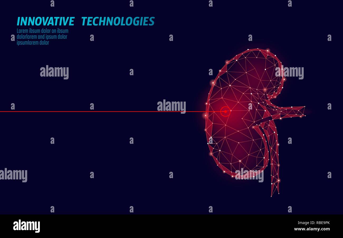 La chirurgie au laser des reins faible fonctionnement poly. Traitement médicamenteux de la maladie de la médecine région douloureuse. Triangles rouges de rendu 3D polygonale forme. Modèle de recouvrement cancer pierres pharmacie vector illustration Illustration de Vecteur