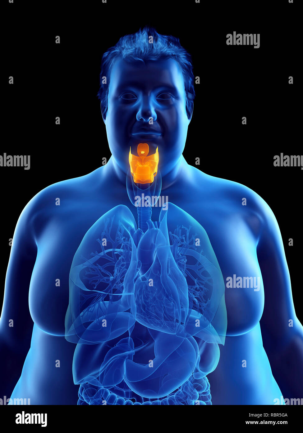 Illustration d'un larynx de l'homme obèse. Banque D'Images