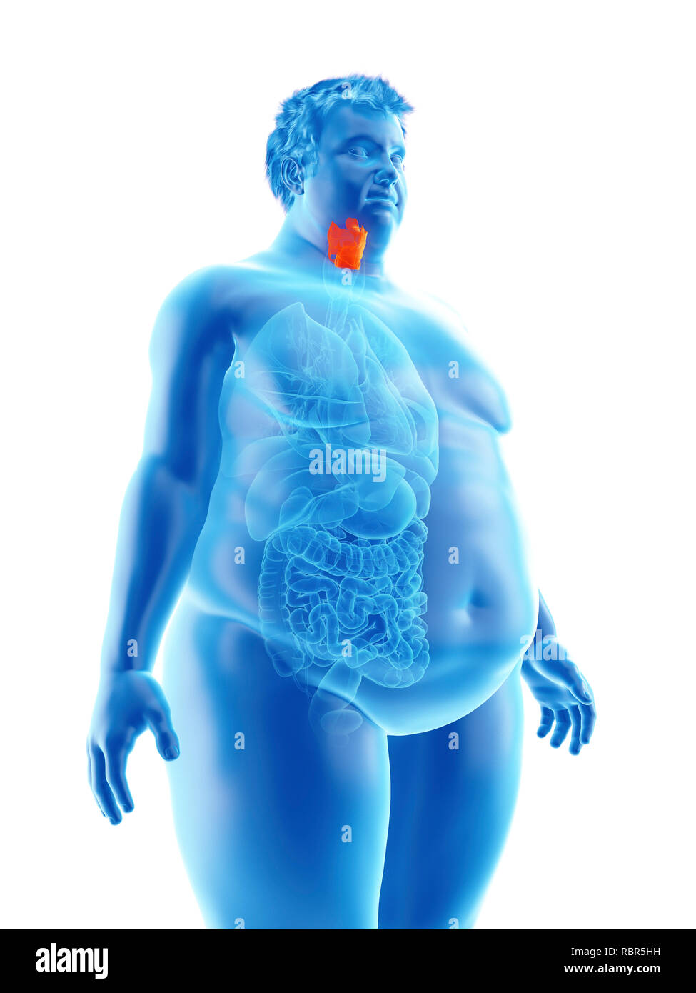 Illustration d'un larynx de l'homme obèse. Banque D'Images