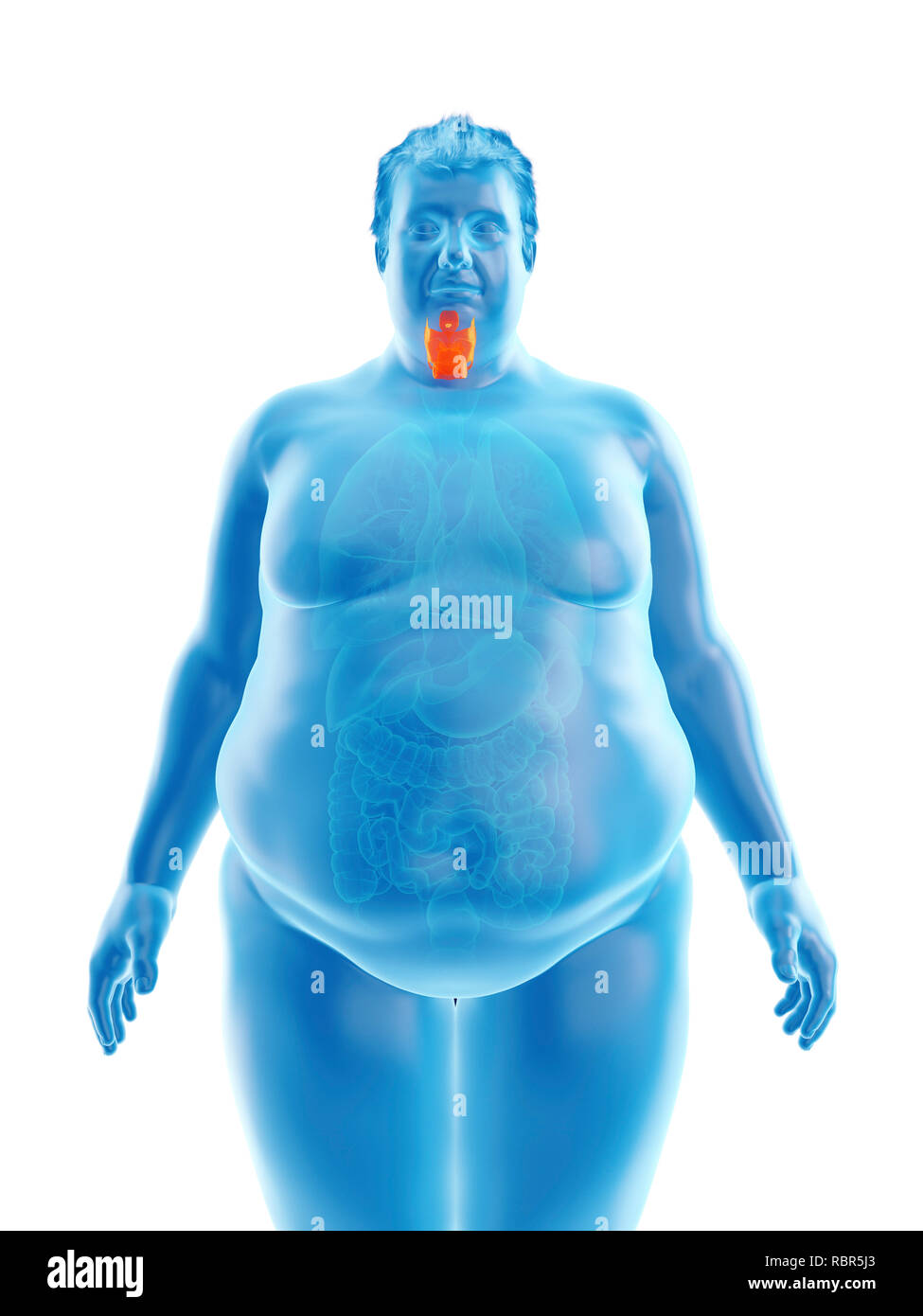 Illustration d'un larynx de l'homme obèse. Banque D'Images
