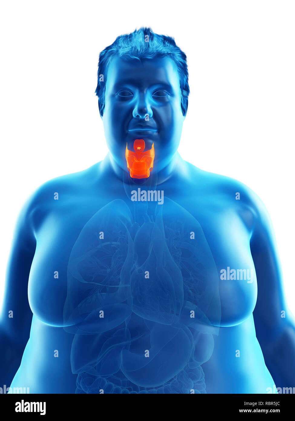 Illustration d'un larynx de l'homme obèse. Banque D'Images