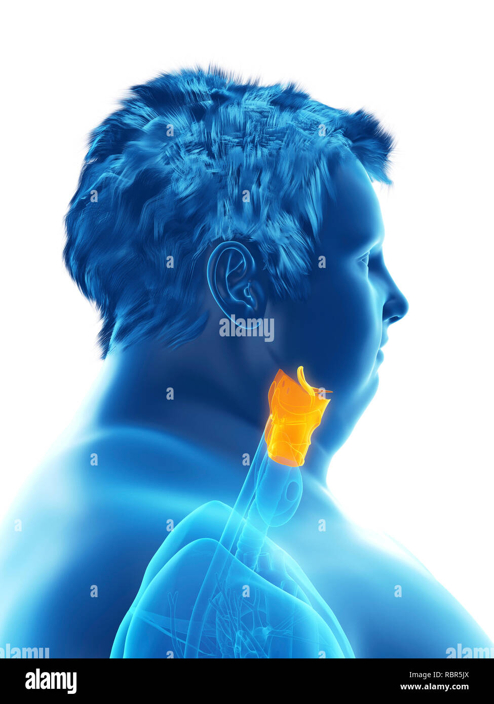 Illustration d'un larynx de l'homme obèse. Banque D'Images