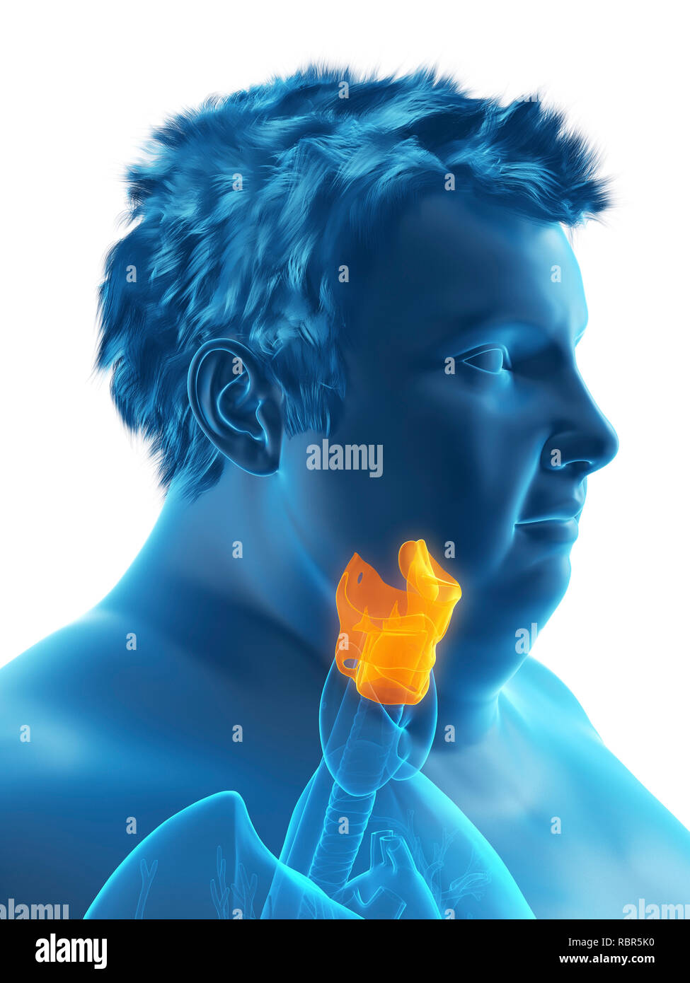 Illustration d'un larynx de l'homme obèse. Banque D'Images