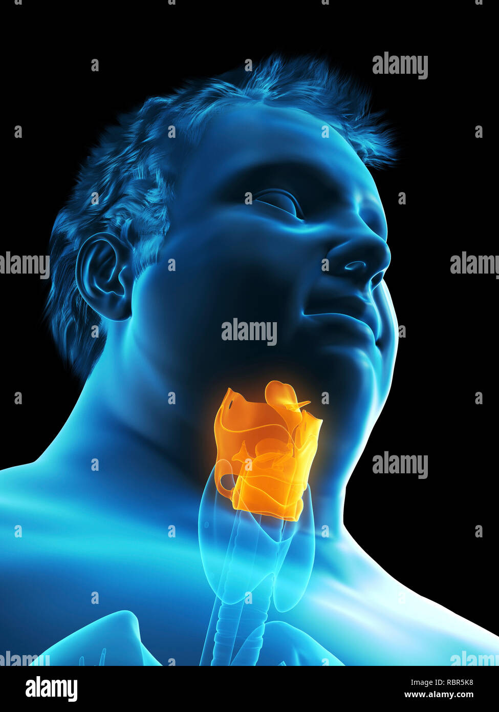 Illustration d'un larynx de l'homme obèse. Banque D'Images