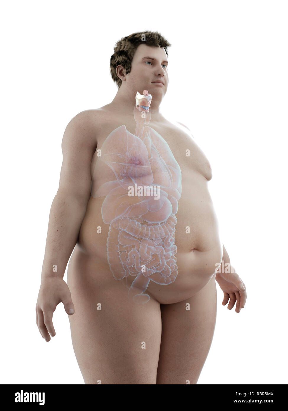 Illustration d'un larynx de l'homme obèse. Banque D'Images