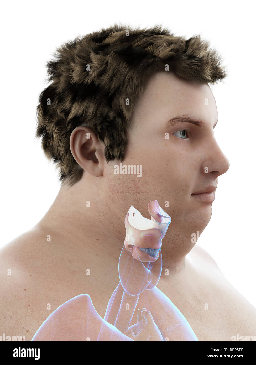 Illustration d'un larynx de l'homme obèse. Banque D'Images