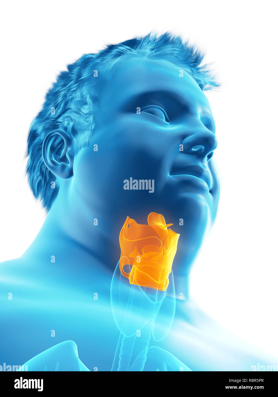 Illustration d'un larynx de l'homme obèse. Banque D'Images