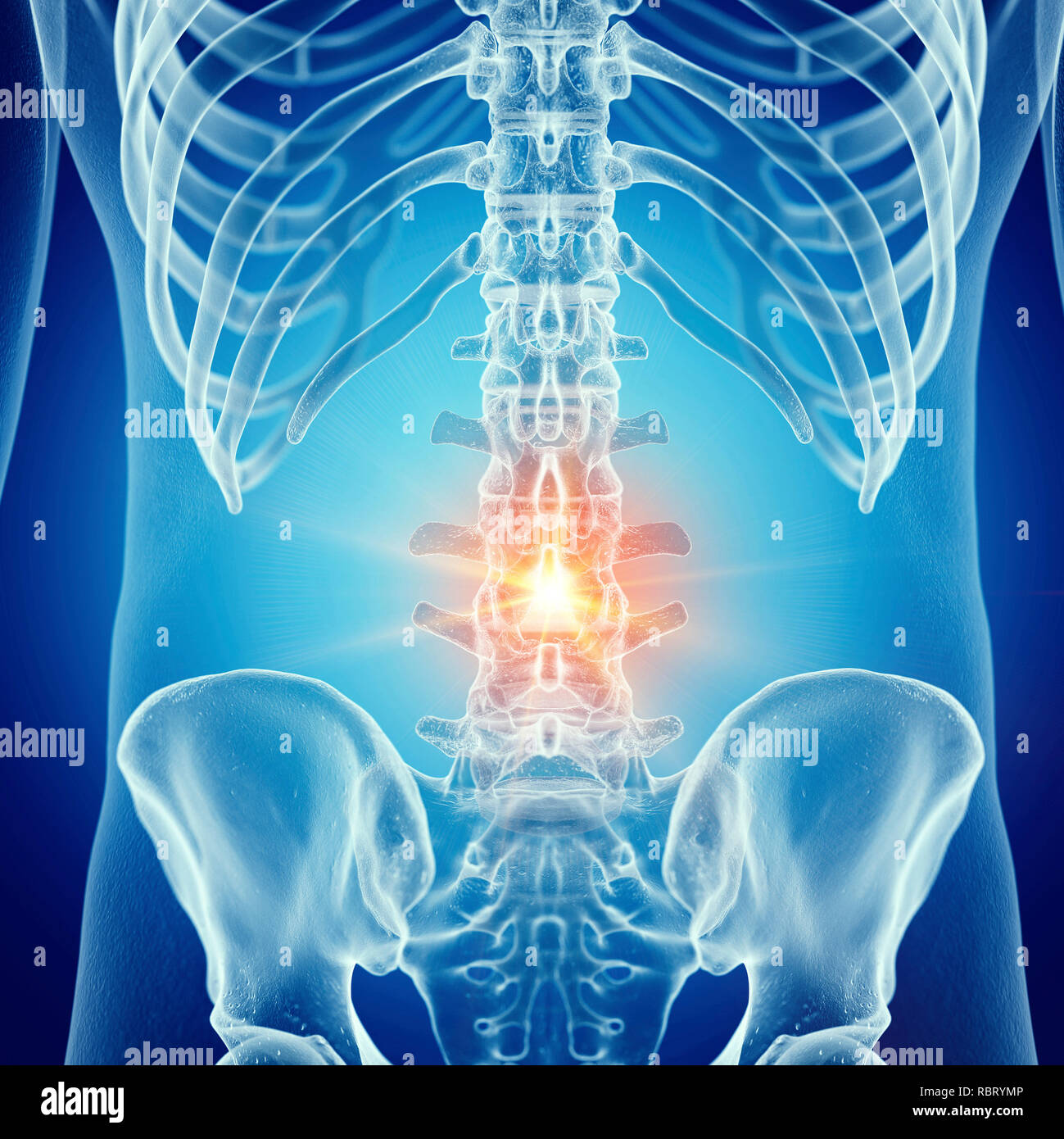 illustration-d-un-rachis-lombaire-douloureux-photo-stock-alamy