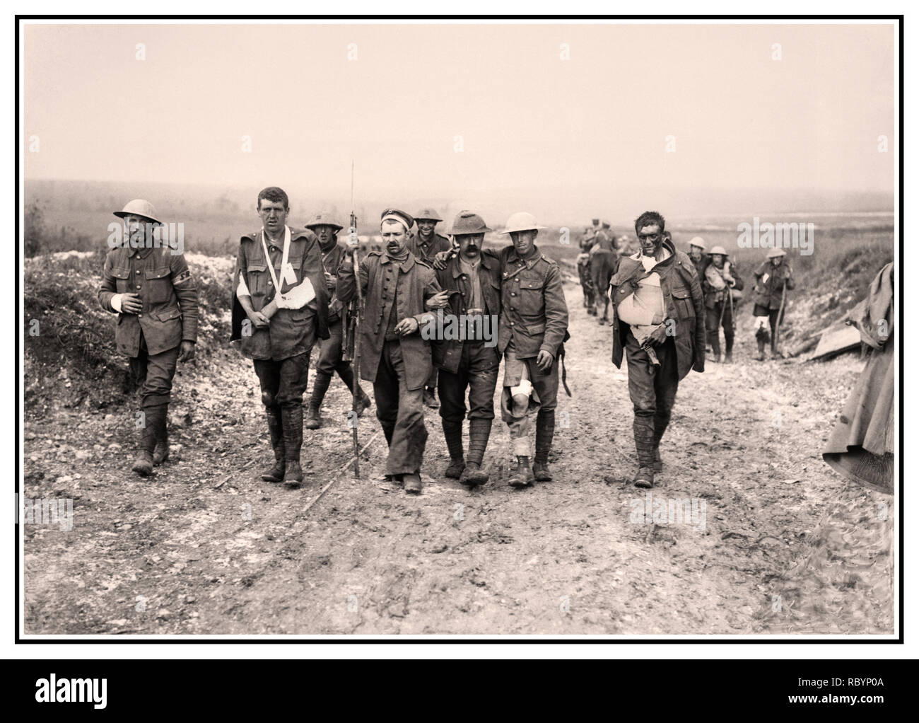 WW1 Bataille de la somme de l'image d'archive d'un prisonnier allemand blessé britannique aidant à faire leur chemin à un poste de secours à proximité de bois Bernafay suite de combats sur la crête de Bazentin, 19 juillet 1916, au cours de la bataille de la Somme. Cinq britanniques et allemandes, quelques blessés, des blessés au moyen d'un poste de secours près de Bernafay France Banque D'Images