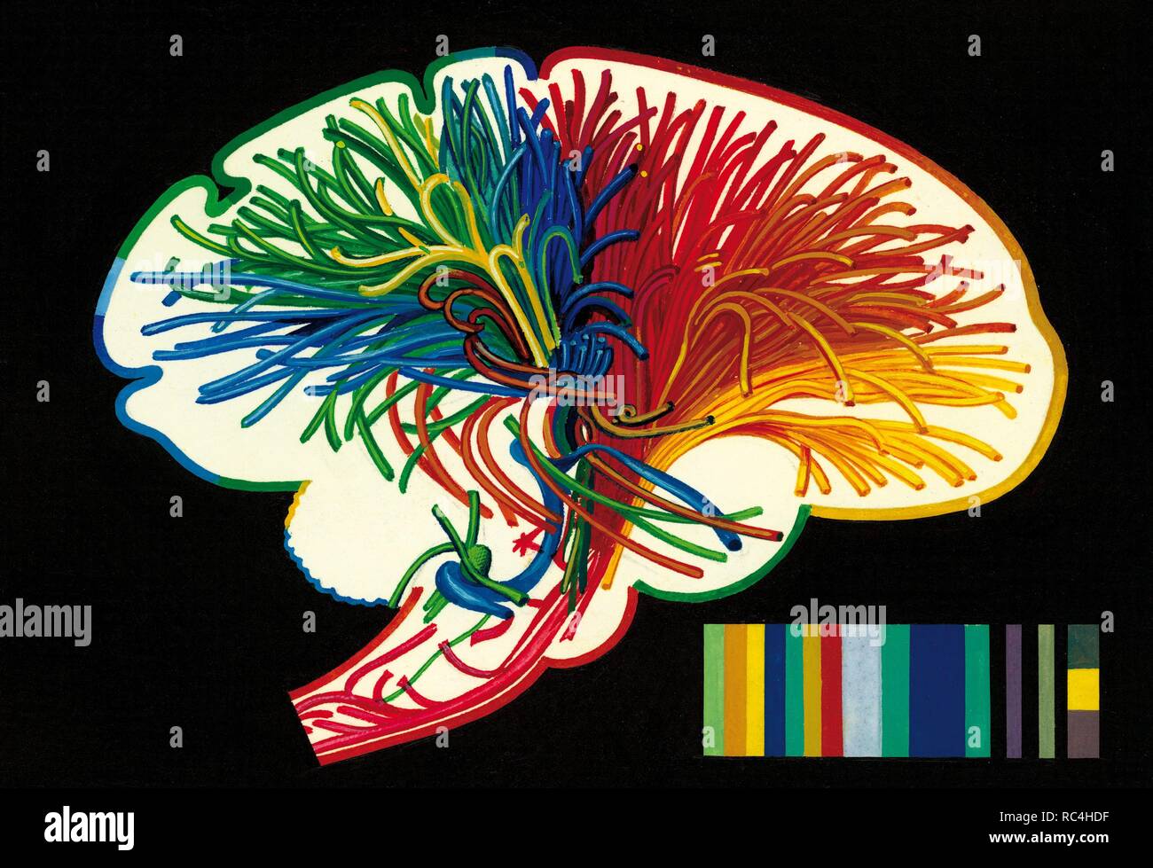 Cerveau. Fibres nerveuses du cerveau qui sont impliquées dans l'analyse de la mémoire des sensations et la pensée.. Dessin. La couleur. Banque D'Images