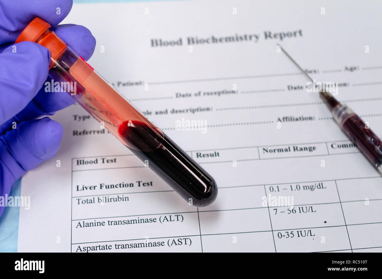Collecte de sang pour analyse de biochimie sanguine pour les maladies métaboliques Banque D'Images