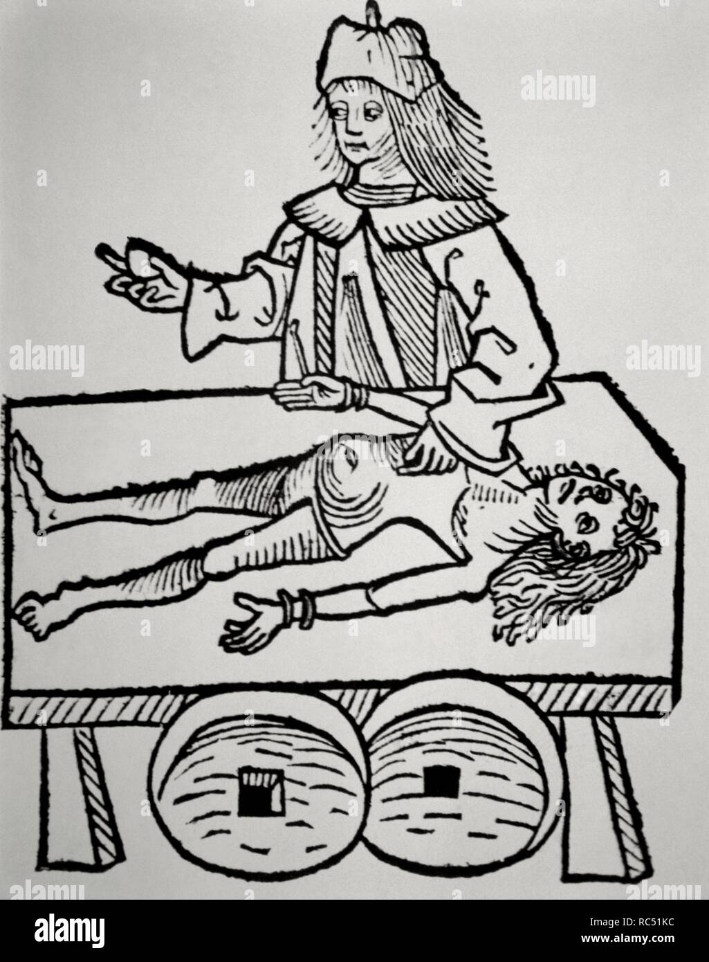 Antécédents médicaux. L'utilisation d'un médecin calcul de la vésicule biliaire. Xilografia. Hortus Sanitatis par Johannes de Cuba (1430-1503). 15e siècle. Banque D'Images