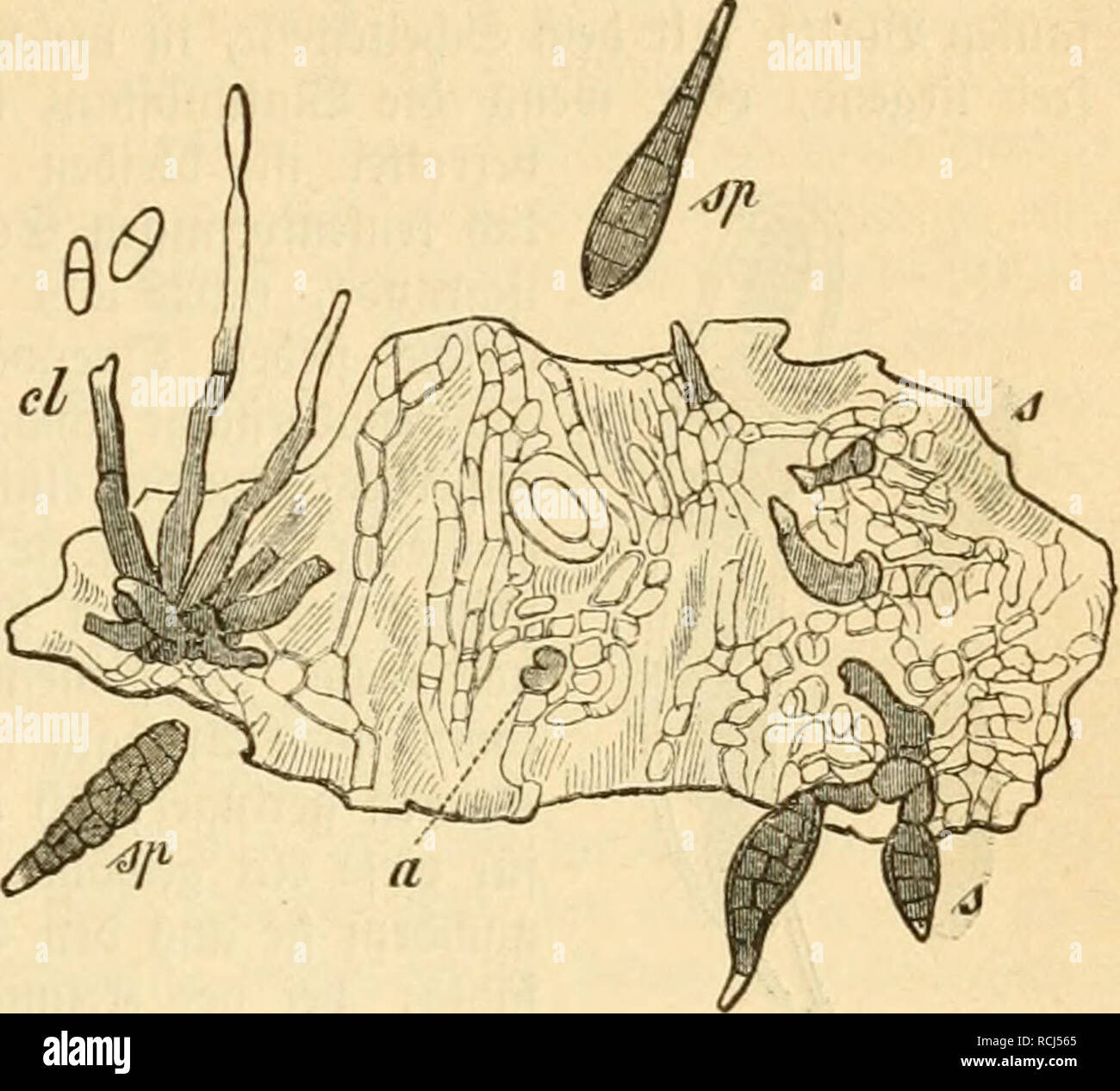 . Die frauenspezifische der Pflanzen, ein handbuch fur terre-und forstwirte, Gartner, gartenfreunde und botaniker. Les maladies des plantes. 13. .'Chapitre : Pyrenomycetps artigen oHöbmunen UberjugeS 299. oniMenfonn 6bie Sporidesmium putre- iaciens^J uckel. J'accarbo^©à beil 5]3fij dans Clasterosporium putrefaciens Sacc. umbenannt Unrecl inbeö ; ganj mit^t, benn der 9^Clasterosporium biejenigen ame fit für ?5o^ aufgeftollt*i"tm morbeu, beren Sporen nur luerfcl €)eibe = luänbe^mcibrenb befi en, ber 9iübenpil fet5)r t)aud ßängSmänbe ciufig) einige dans befiel poren ben ©, maö alfo ber (5t) arafter Sporidesniiinu üvous trouverez sur fit. Banque D'Images