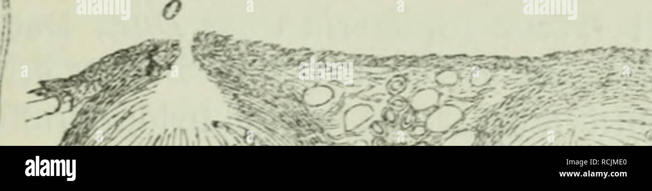 . Die Frauenspezifische der Pflanzen ; Ein Handbuch für Land- und Forstwirte, Gärtner, Gartenfreunde und Botaniker. Les maladies des plantes. 13. Chapitre : les Pyrénomycètes 455 auö 5af)ire{(i)en, il^fciben ^feinen, njeld jiuifdien e)ben tu unb B^§^n ü être eiüebeö ©ma(i)fen) baburd^ unb ba le^^^tere mit U2"na^^^^m ber" ibrouafal ftränge oerbrängen}, jo ba] beö eraebeS une Stelle ©ba§&gt ; tritt du stroma. Stile förensen leiteten^foiuo beä, l'Cberf bie ber(äd)c être§ 33latte£i, als im Innern bie) aud befinblid)cii, [inb burd) eine 8d)mar3NNG ber ^ilj^^^iie faben être net. Sie fd)iüar5e @s5id)id)t liegt innerl)alb ber GPIB Banque D'Images