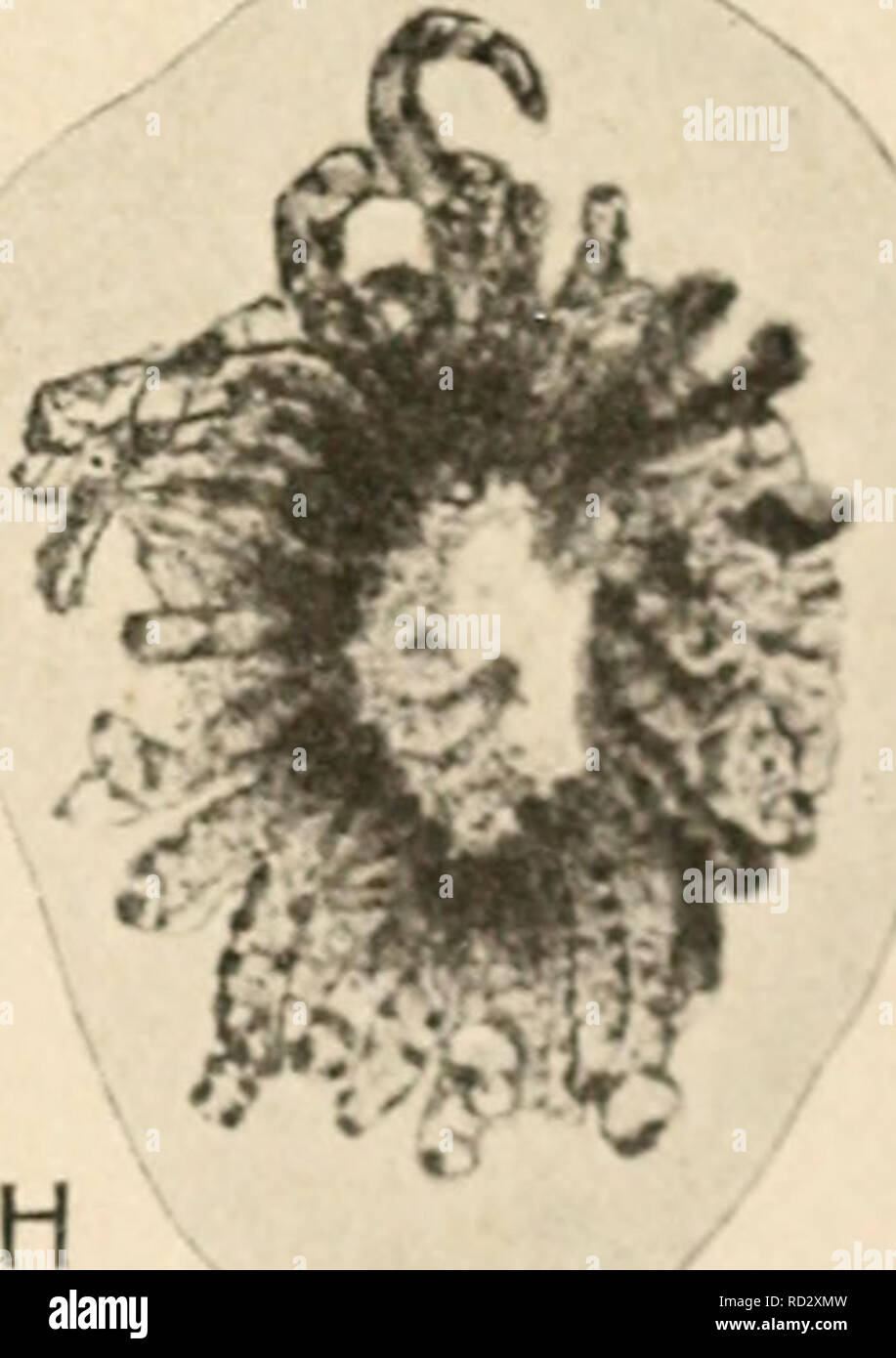 . La cytologie, avec une référence particulière à la noyau de métazoaires. Les cellules. Fig. 3.. 00 La mitose dans les cellules du mésenchyme (Lepidosiren). Au repos, un noyau ; B, très début de la prophase ; C, D, E ; prophase moyen, la fin de la prophase. La membrane nucléaire a disparu et les chromosomes deviennent attachés à l'axe des fibres. F, métaphase (vu du dessus). Seulement environ la moitié des chromosomes .ire illustré. G, l'anaphase ; H, télophase, reconstruction de l'un des noyaux ; I, deux des chromosomes de H, en section transversale et sous un grossissement plus élevé.. Veuillez noter que ces images sont extraites du Banque D'Images