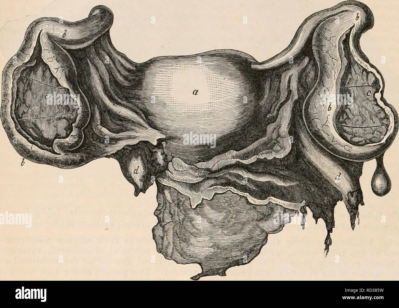 La Cyclopaedia D Anatomie Et Physiologie Anatomie Physiologie Zoologie 618 L Uterus Et Ses Appendices Le Tube Murs Dont La Distension De Capilla Le Tube Sont Patentes Le Fluide Peut S Echapper Dans