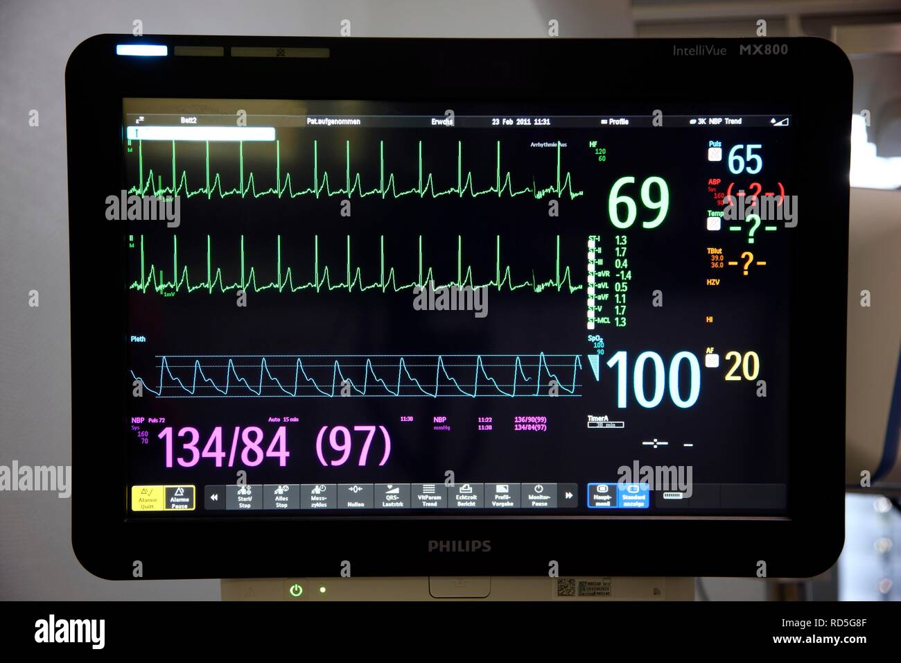 Appareil pour traitement médical et la respiration artificielle du patient, la surveillance automatique des fonctions vitales Banque D'Images