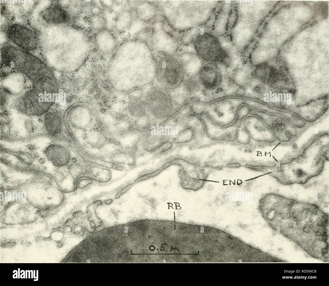 . La microscopie électronique ; actes de la Conférence de Stockholm, septembre, 1956. La microscopie électronique. 173 de la thyroïde d'embryon de poulet. Fig. 2. Section à travers la partie basale d'une cellule de la thyroïde et d'un capillaire montrant des discontinuités de l'endothélium. BM  = base- ment membrane : FIN -Â ^- : l'endothélium RB -- red blood corpuscule. 62 Agrandissement,C00. plus ou moins distinctes et la membrane assez dense de la membrane basale de l'endothélium continue uninter- vée sur ces domaines. La largeur de la discon- tinuities est d'environ 300 A. Références 1. Braunsteiner, H., Fellinger, K., et Pakesch, F., endocrinologie, 53 123 ( Banque D'Images