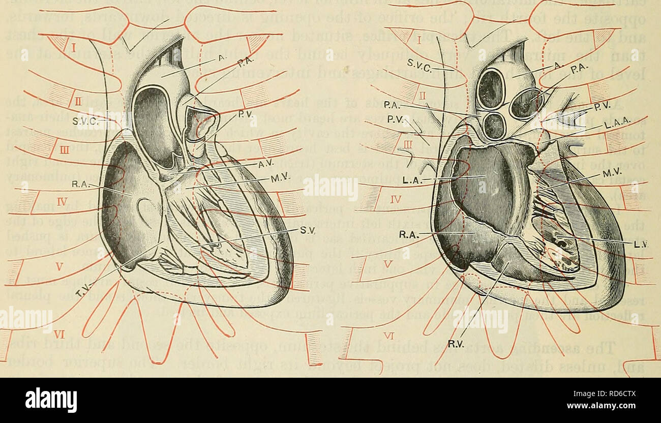 . Cunningham's Text-book de l'anatomie. L'anatomie. Fig. 1099. Fig. 1100. À partir de photographies d'un objet, la formaline-trempée avec le cœur disséqué sur place, afin de montrer les relations de ses cavités et les vannes de la paroi antérieure du thorax. Dans la Fig. 1097 la paroi antérieure du ventricule droit a été supprimé et l'artère pulmonaire ouvert. Dans la Fig. 1098 la partie antérieure de l'aorte ascendante des murs et de l'oreillette droite ont été supprimés ; aussi la partie antérieure cuspide de la valve tricuspide. 111^TCeater itraltv FlS'mpartie Â°f le septum interventriculaire beeu nas retiré, exposant la partie antérieure cuspide de Fig' Banque D'Images