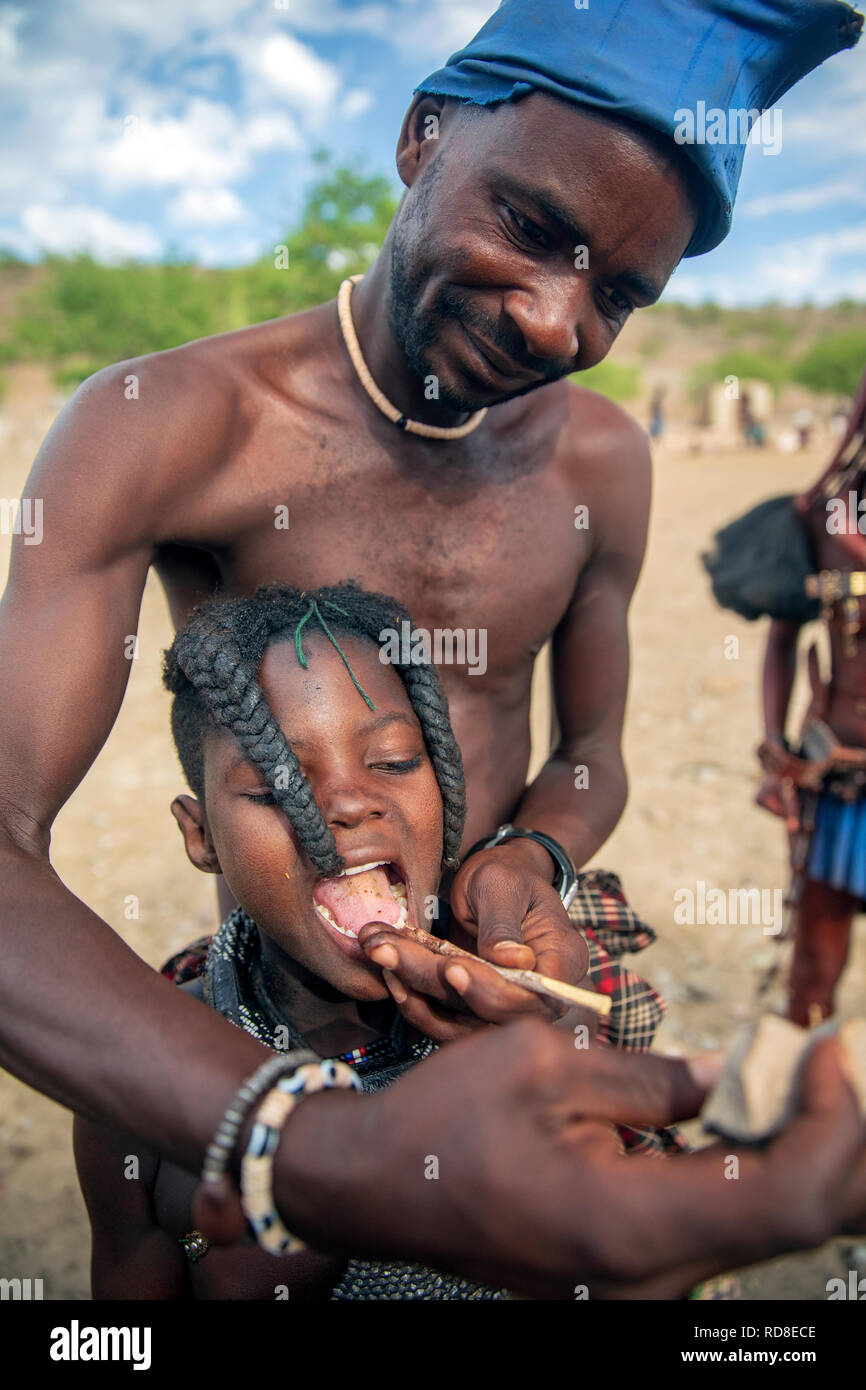 Himba démontrant comment ils enlèvent les dents du bas de l'enfant - Damaraland, Namibie, Afrique Banque D'Images