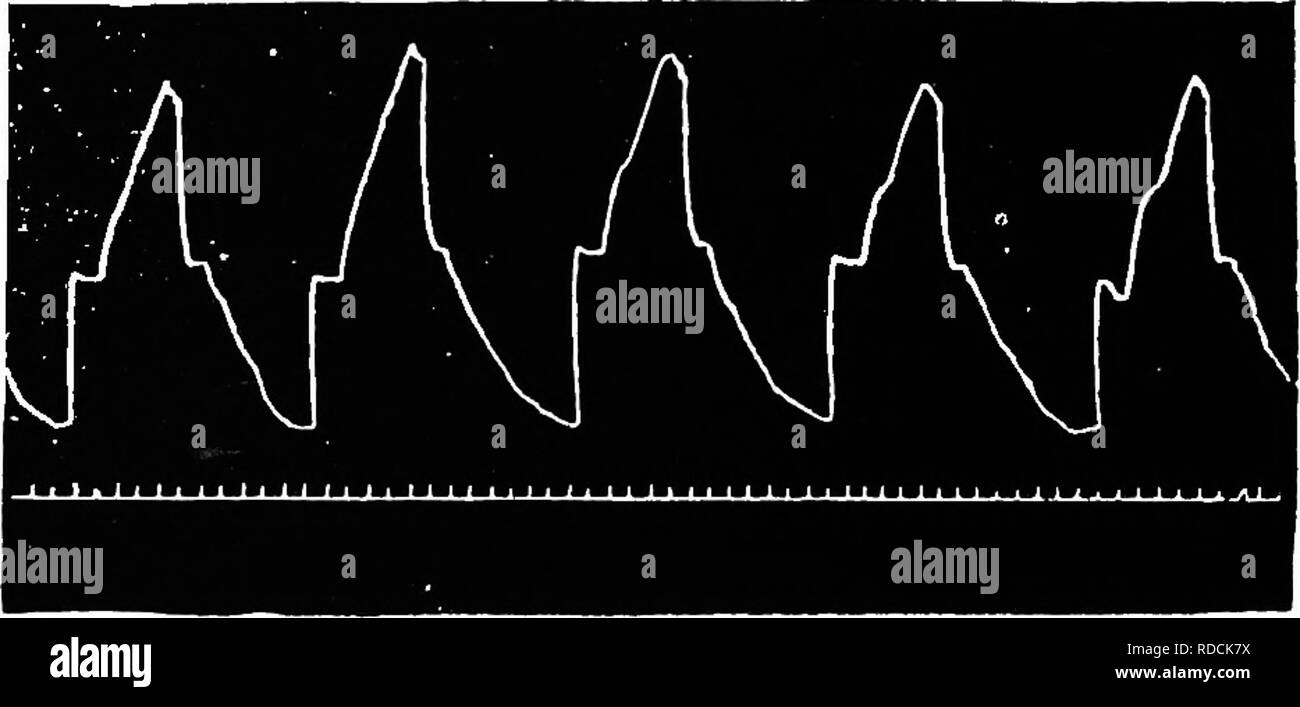 . Diagnostic clinique de la maladies internes d'animaux domestiques. La médecine vétérinaire ; diagnostic, vétérinaire ; médecine vétérinaire. La dyspnée expiratoire en cas d'emphysème Pulmonum. Fig. 28d.. La dyspnée inspiratoire et expiratoire en cas d'Inflammation des poumons ou de la paroi thoracique.. Veuillez noter que ces images sont extraites de la page numérisée des images qui peuvent avoir été retouchées numériquement pour plus de lisibilité - coloration et l'aspect de ces illustrations ne peut pas parfaitement ressembler à l'œuvre originale.. Malkmus, Bernhard, 1859-1925. Chicago, A. Eger Banque D'Images