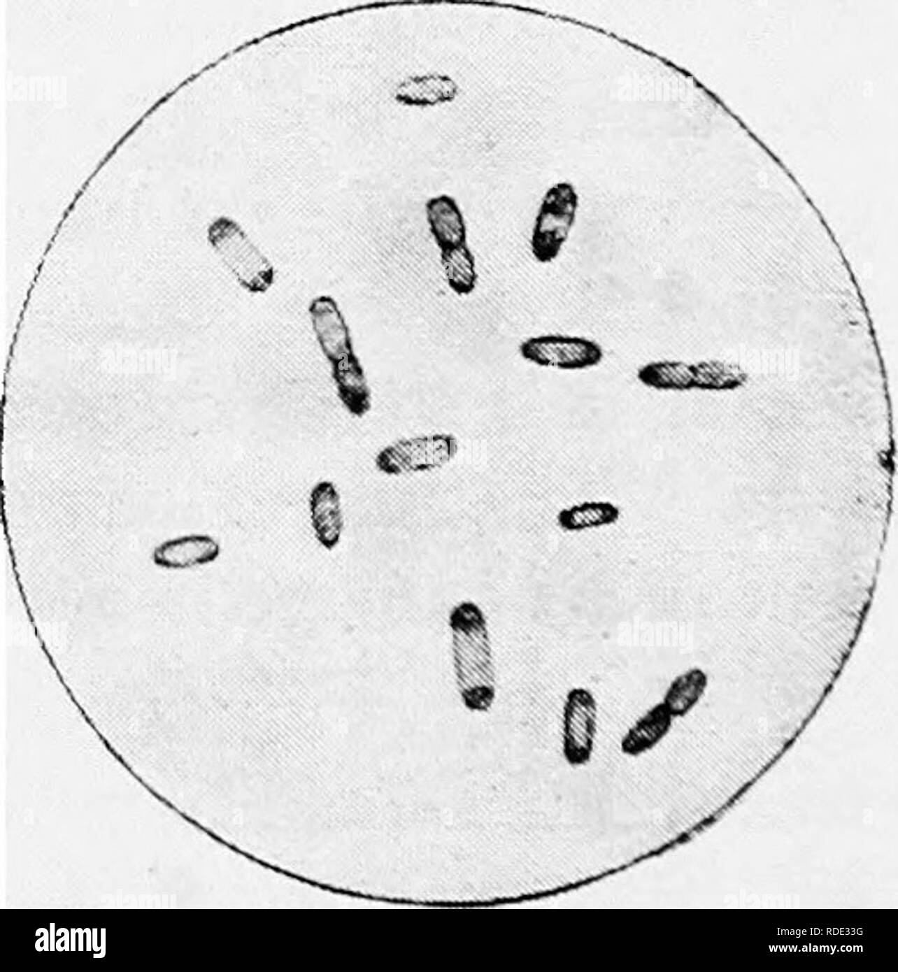 . Minnesota maladies des plantes. Les maladies des plantes. Fic. 194.-pourriture noire d'Apple. Après Clinton. fruits, lorsqu'il est attaqué, se tourne d'abord un rouge-brun mais plus tard être blaclf- vient. Sur certaines parties de l'arbre attaqué le champignon pro- duces ses spores. Il s'agit d'un champignon "imparfait" et produit des spores dans de petites capsules, qui apparaissent sur la feuille, brindille ou taches de fruit noir comme de minuscules verrues. Ces ouvertes sur l'extérieur par l'intermédiaire de pores minute dont les spores, qui sont coupées de threads lin- ment l'intérieur de la capsule, sont exclues. Le traitement qui est utilisé contre la tavelure est habituellement recom Banque D'Images