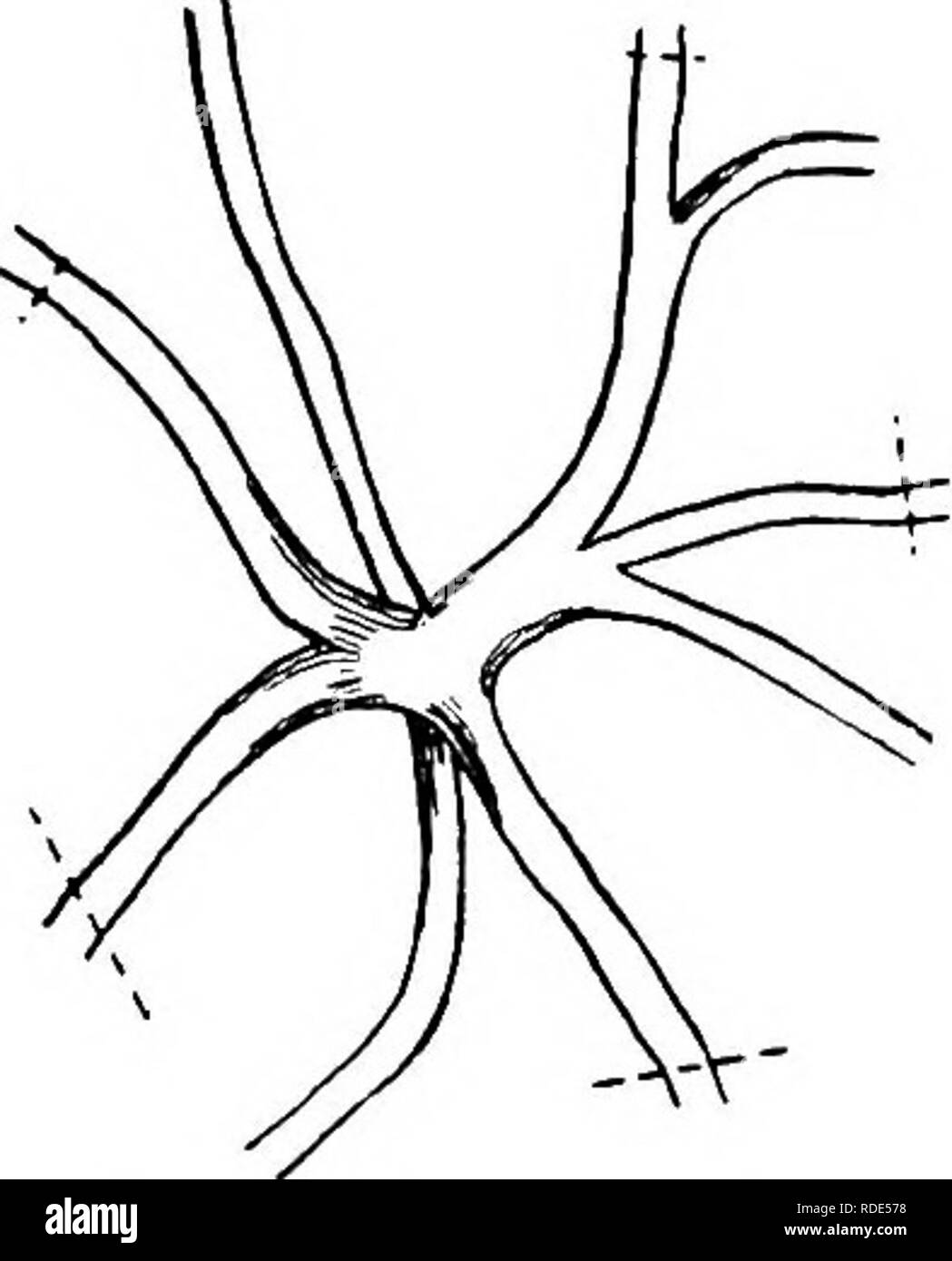 . Principes de culture végétale : an elementary treatise conçu comme un texte-livre pour les débutants dans l'agriculture et l'horticulture. L'horticulture, la botanique. Pro-pagation par greffage. 211 devrait être fait horizontalement, tvi de donner les deux cions inséré l'égalité des chances de croissance. Les deux devraient l'cions dans une succursale de l'expansion, le plus faible doit être élagué au loin plus tard. Comme la croissance commence, tire de l'action doit être éliminé à l'(390).. Veuillez noter que ces images sont extraites de la page numérisée des images qui peuvent avoir été retouchées numériquement pour plus de lisibilité - coloration et l'aspect de ces illustrations ne peut Banque D'Images