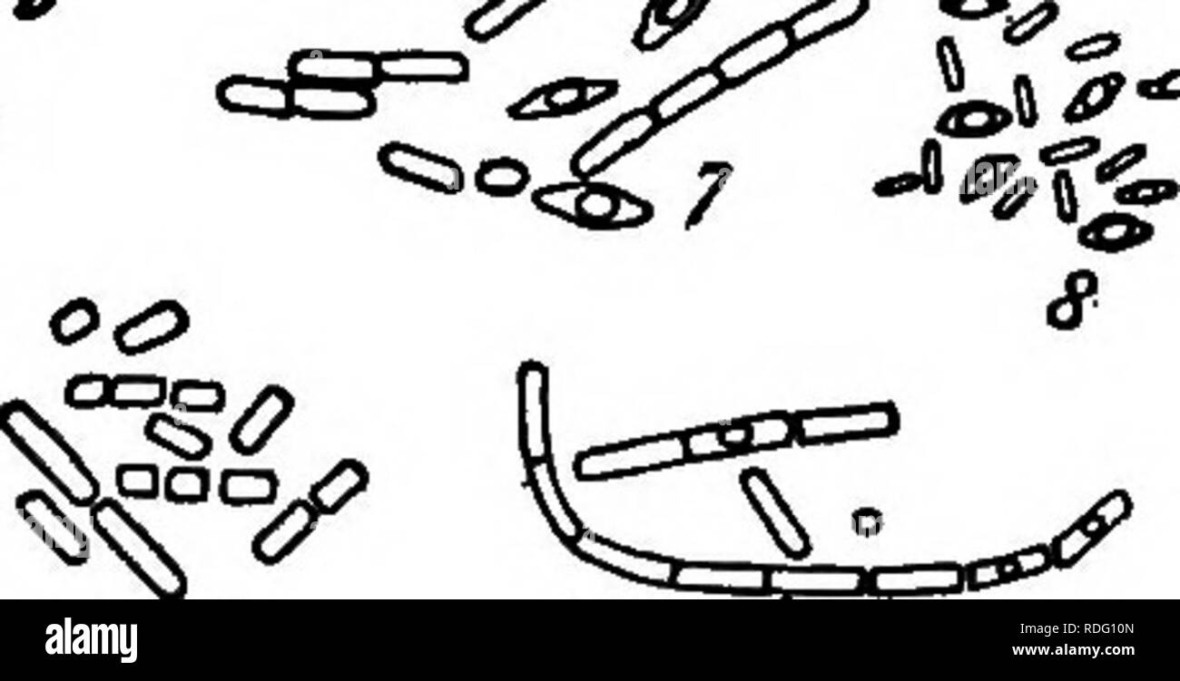 . Les bactéries, levures et moisissures dans la maison. Bactériologie, levures, moisissures (champignons). Le lait appartiennent à un type connu sous le nom de bactéries lactiques (Fig. 67). Ces produit un changement dans le sucre du lait, le transformer en acide lactique, ce qui provoque le lait au goût aigre et cailler. Le caillage et perturbe nos ne sera jamais se produire si les bactéries peuvent être conservés hors de la lait. Bien que la dégradation est une nuisance, si n'est pas nuire à la salubrité du lait, lait aigre et peut être utilisé librement sans son goût désagréable. En effet, c'est aigre, dans certaines circonstances, desir- en mesure, puisque le lait aigri correctement est prot Banque D'Images