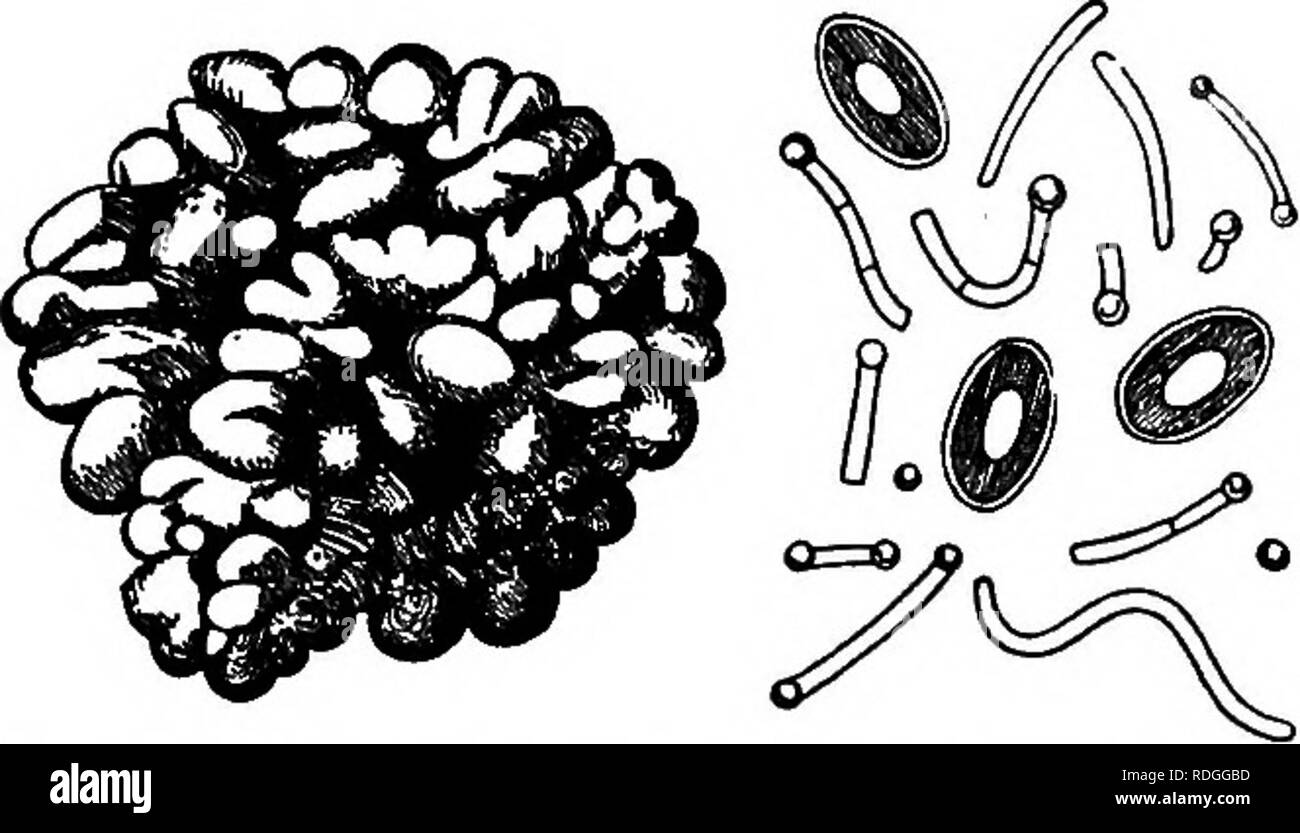. Les bactéries par rapport à la vie à la campagne. Les bactéries. Le kéfir et Kumiss 379. Fig. 60. Les grains de kéfir, et les micro-organismes du kéfir. (Après Freudenreich.), lors de l'adouci, ils sont placés dans une petite entité quan- de lait. Le lait est brassé, parfois versé dans des bouteilles sur la fin de vingt-quatre heures, et en deux ou trois jours est prêt à l'emploi. Le kéfir a ainsi préparé un agréable goût acide et contient, en outre, les petites quan- quantités d'alcool. L'examen microscopique montre la les grains de kéfir se compose de levures et bactéries. Il y a en eux, en plus de la levure de bière ordinaire, une espèce bactérienne à Banque D'Images
