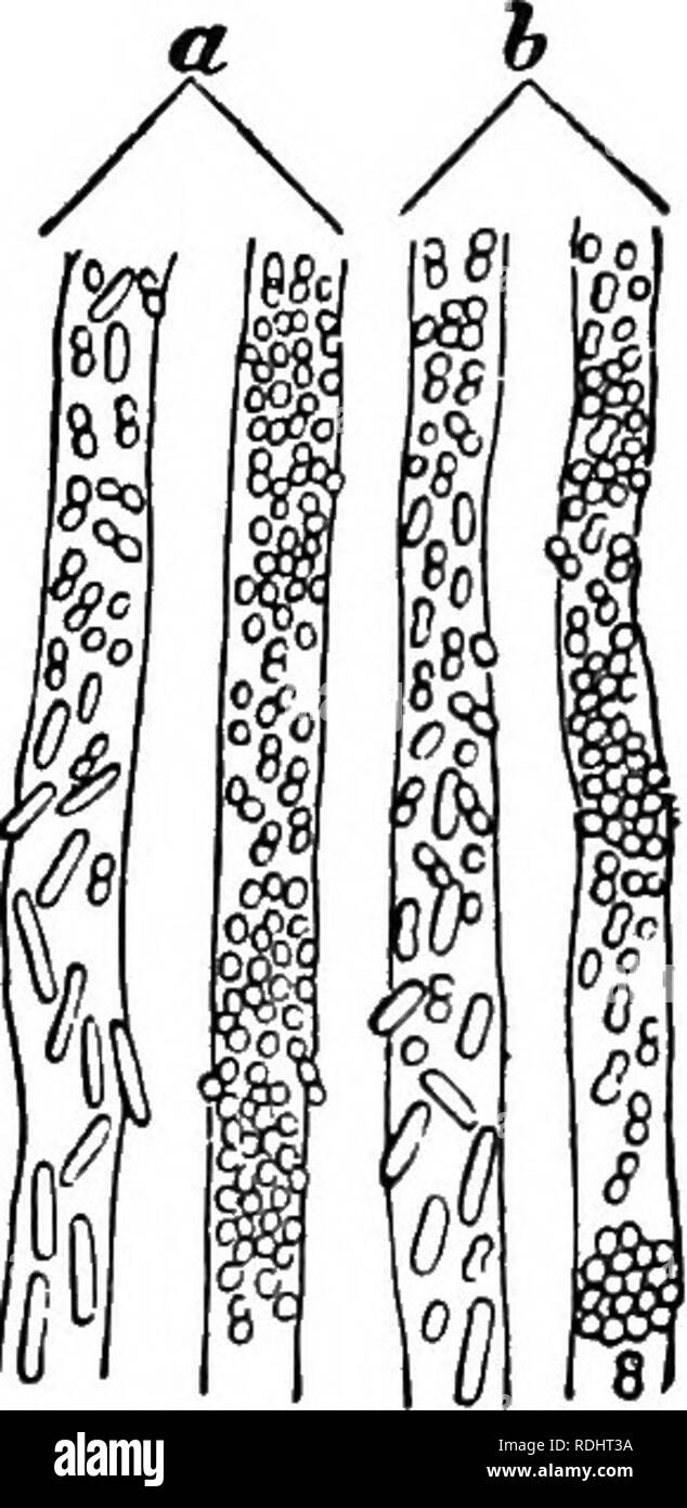 . Les microbes, fermente et moules . Les bactéries ; Champignons ; la fermentation. 178 MICROBES, FEEMENTS, et moisissures. censée être la cause de la carie précoce des dents, en particulier chez les enfants qui les consomment en excès. Le microbe qui MiUer a trouvé pour être le plus commun dans les dents de- cayed est très polymorphe. Microccocus, bactérie, des chaînes et des filaments ne sont que des phases différentes de la même plante, qui a également pro- duces fermentation acide dans la bouche, et la formation d'acide lactique. À l'intérieur de la dentine tubules, une section examinée au microscope montre aU les stades intermédiaire entre le mic isolés Banque D'Images
