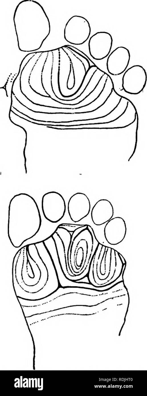 . La biologie de jumeaux (mammifères) . Des jumeaux. Fig. 5S--seul-imprime des jumeaux siamois Margaret (ci-dessus) et de Marie (ci-dessous). Notez que le droit de Margaret est une image inversée de la gauche de Marie, mais que le droit de Marie montre un modèle totalement différent de sa gauche. (À partir de Wilder.) La seule gauche de Marie et le droit seul de Margaret sont plus presque identique que sont le droit et gauche semelles de Margaret, qui est un bon cas d'imagerie-miroir. Veuillez noter que ces images sont extraites de la page numérisée des images qui peuvent avoir été retouchées numériquement pour plus de lisibilité - coloration et l'apparence Banque D'Images