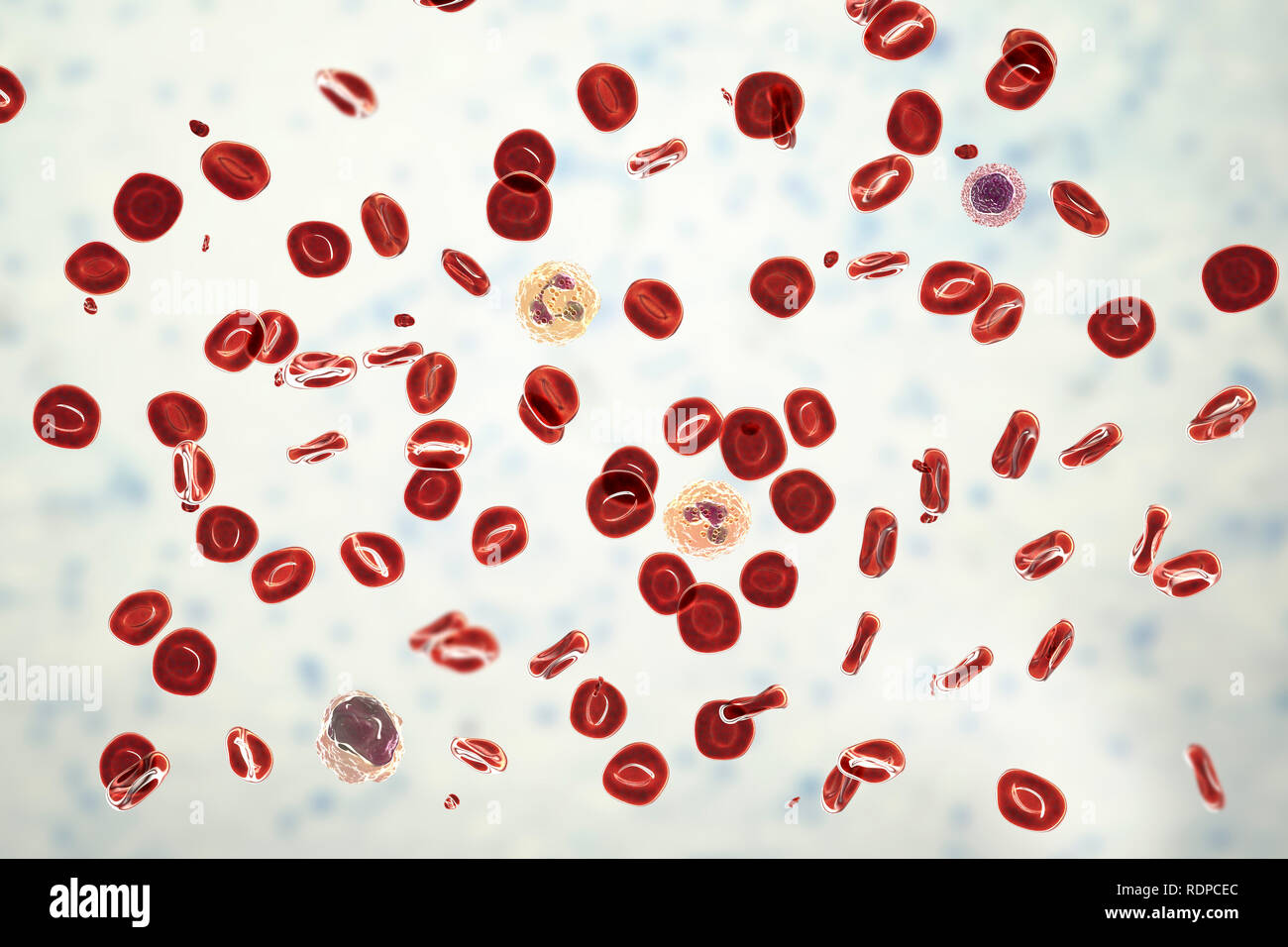 Frottis sanguin normal. Illustration de l'ordinateur, les globules rouges,  les plaquettes (petites particules rouges), les neutrophiles (deux cellules  de sang blanches au centre), des monocytes (bas gauche) et de lymphocytes  (à droite