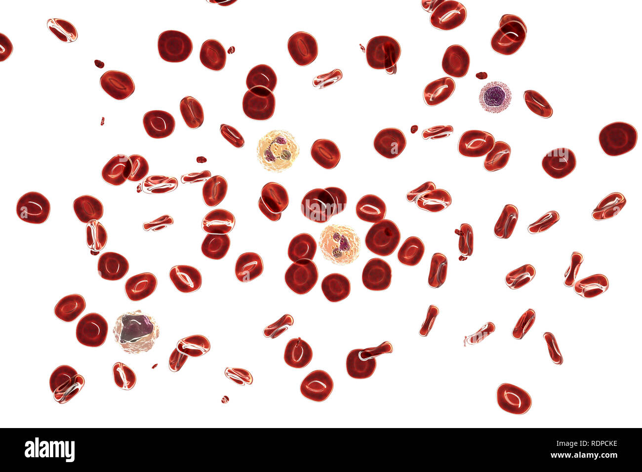 Frottis sanguin normal. Illustration de l'ordinateur, les globules rouges,  les plaquettes (petites particules rouges), les neutrophiles (un taux de globules  blancs dans le centre et l'autre - vers le bas à droite),