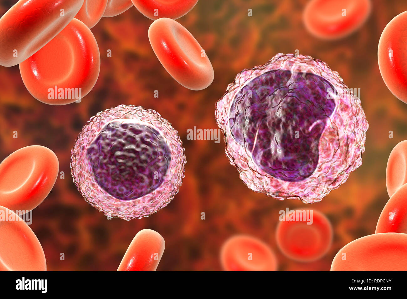 De monocytes et de lymphocytes (droite) (gauche) de globules blancs dans un frottis sanguin, illustration de l'ordinateur. Les monocytes sont les plus gros globules blancs ; ils engloutir et digérer l'invasion de bactéries et de débris cellulaires. Les lymphocytes sont impliqués dans la production d'anticorps et infectés par un virus attaque et les cellules tumorales. Banque D'Images