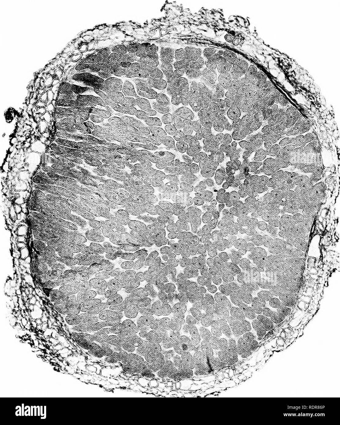 . Les bactéries dans le cadre de maladies des plantes. Bactériologie ; maladies des plantes. J04 LES BACTÉRIES DANS LE CADRE DE MALADIES DES PLANTES. bactcrioiden du mungo," et (3) vessie bactéroïdes. La troisième forme se produit lorsque les bactéries ont énormément. multipHed Le hcmmung bacterioiden de se produire à l'extérieur de la tissu bactéroïde dans presque toutes les cellules externes du nodule, et il n'est pas rare dans l'écorce de la racine. Beyerinck trouvés que les nodules n'a pas élaboré sur les racines des plantes cultivées dans sterihzed terre. Frank est parvenu à la même conclusion en 1879, Hellriegel et Wilfarth en 1886, et Ward en 1887. Plantes en soi Banque D'Images