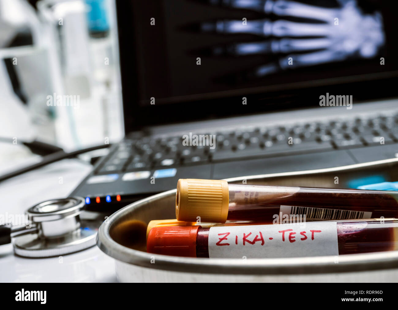 Test de zika virus, un échantillon de sang dans un hôpital, conceptual image Banque D'Images