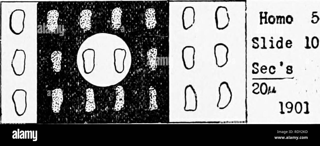 . Le microscope : une introduction aux méthodes microscopiques et à l'histologie. Les microscopes. CH. VII] des démonstrations en classe microscope est limitée. Avec elle on peut montrer d'organes adultes ou embryonnaires, et la morphologie générale. Pour le démon- stration précis de cellules et de cellules au microscope la structure elle-même doit être utilisé. Comme une déclaration générale concernant l'utilisation de la projection micro- portée à des fins de démonstration, on peut dire qu'il est tout à fait satisfaisant pour les objets et les détails qui montrent sous le microscope avec des objectifs jusqu'à 16 mm. L'accent équivalent. Pour les objets et les détails req Banque D'Images