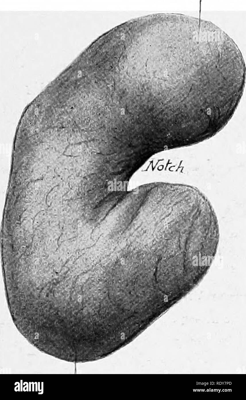 . L'anatomie de l'animaux domestiques . Anatomie vétérinaire. Organes urinaires DU COCHON 557 la face dorsale de la frontière chaque. La surrénale gauche se trouve sur la face interne de la veine cave postérieure, juste derrière la partie antérieure de l'artère mésentérique, et est donc pratiquement en position médiane. Elle est aplatie, et irrégulièrement triangulaire ou en forme de cœur. Sa face gauche est lié à la partie dorsale du sac le rumen. Sa face droite est liée à la veine cave, et présente une grande veine prélevée. La frontière postérieure ou de la base est une entaille profonde. La surrénale gauche ne migre pas avec le chevreau- ney, mais re Banque D'Images