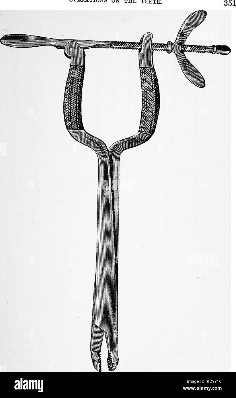 . Dispositif manuel de chirurgie vétérinaire. Chirurgie vétérinaire. OPEEATIONS SUR LES DENTS. Fig. 357.-Dent de Bouley. touches jaws par laquelle l'extraction de la dent est considérablement faciliter- ed. si l'animal n'a pas été mis sous anesthésie générale la luxation de la dent est très douloureux, et souvent accompagnées de. Veuillez noter que ces images sont extraites de la page numérisée des images qui peuvent avoir été retouchées numériquement pour plus de lisibilité - coloration et l'aspect de ces illustrations ne peut pas parfaitement ressembler à l'œuvre originale.. Liautard, Alexandre Franc ?ois Augustin, 1835-. New York, Sa Banque D'Images